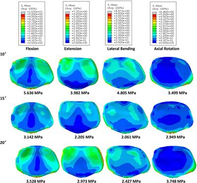 Biomechanical evaluation of a short-rod technique for lumbar fixation surgery